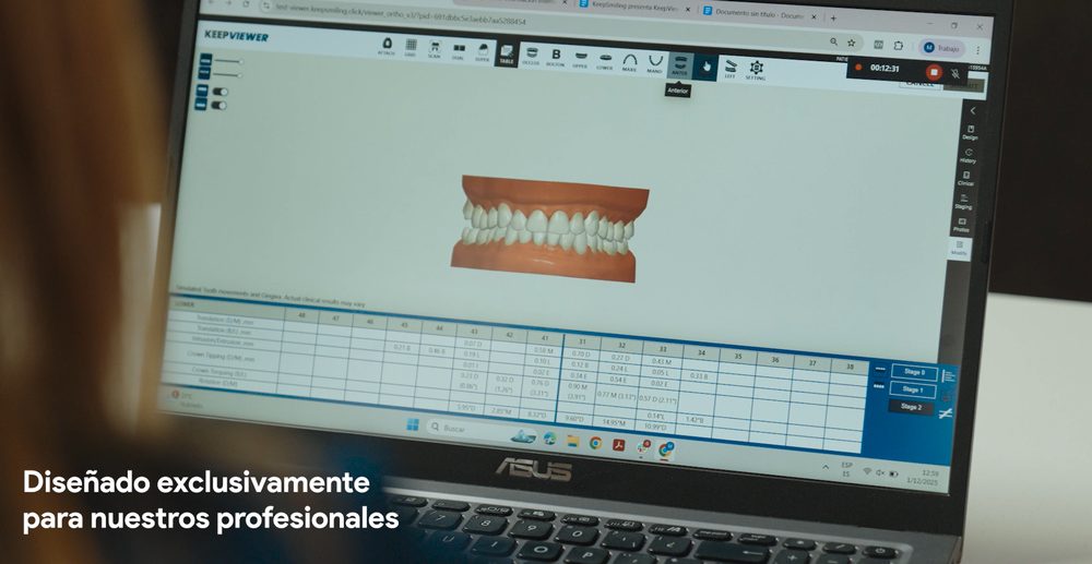 KeepViewer en pantalla
